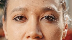 Blépharoplastie